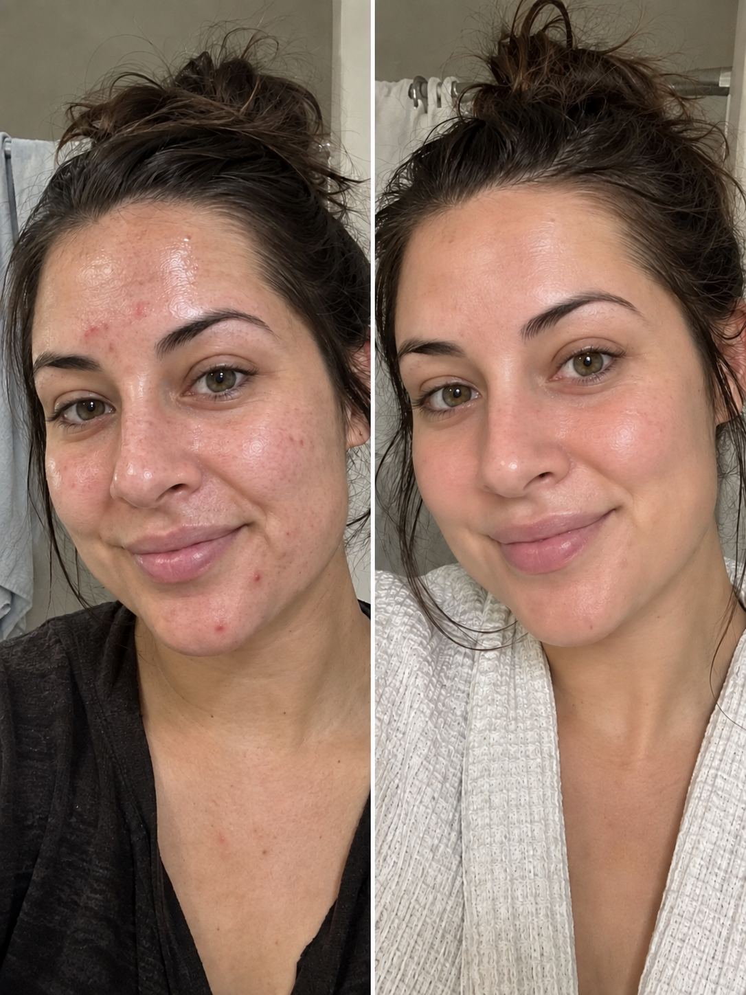 Before and after skincare comparison showing more even-looking skin